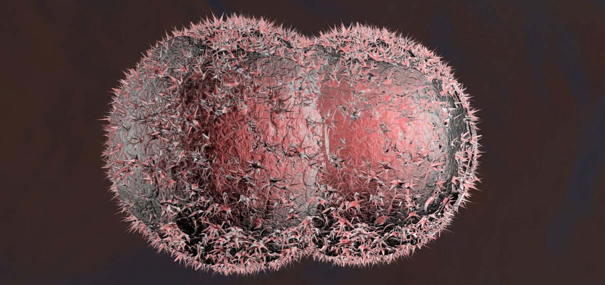 Καρκινικό κύτταρο σε μικροσκόπιο
